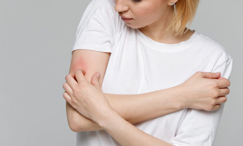 ماذا تعرف عن حساسية العطور؟ أعراضها وطرق الوقاية منها